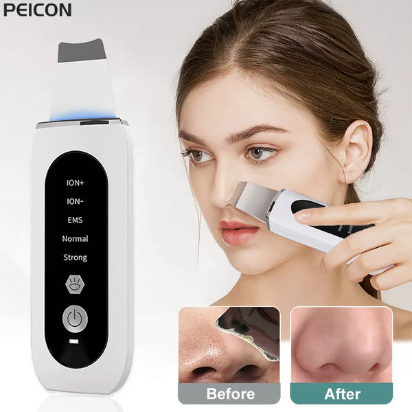 Ultrasonic Skin Scrubber Deep Face Cleanser