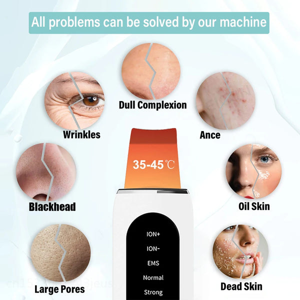 Ultrasonic Skin Scrubber Deep Face Cleanser