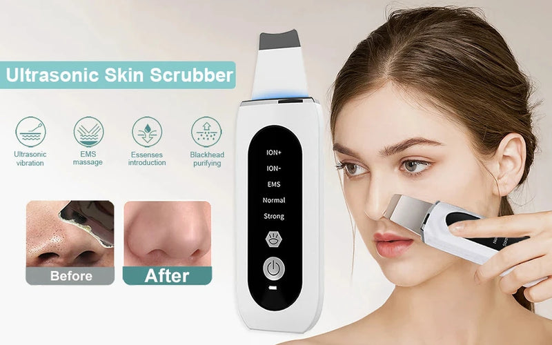 Ultrasonic Skin Scrubber Deep Face Cleanser - aquila Bask